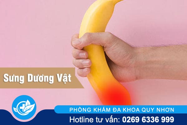 Cảnh báo hiện tượng sưng dương vật ở nam giới