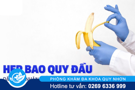 Hẹp bao quy đầu – Hiện tượng không nên xem thường