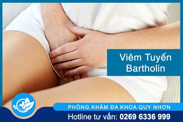 Những sự thật về viêm tuyến bartholin