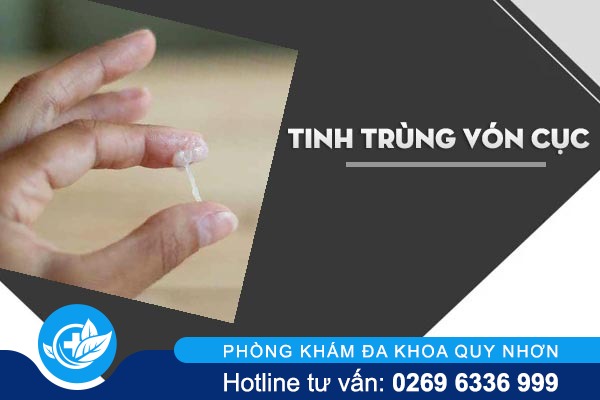 [S.O.S]Tinh trùng vón cục không nên xem thường