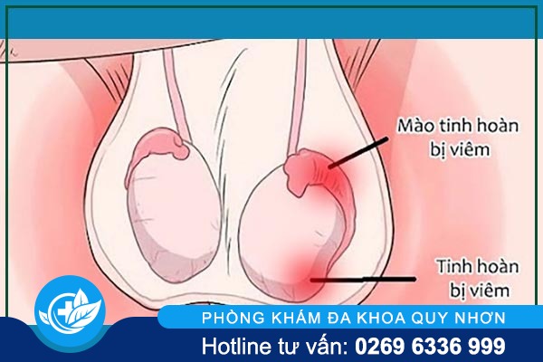 tong-hop-cac-benh-tinh-hoan-thuong-gap-o-nam-gioi-1