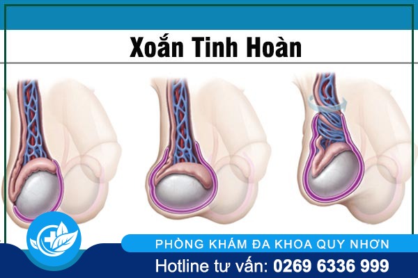 tong-hop-cac-benh-tinh-hoan-thuong-gap-o-nam-gioi-2