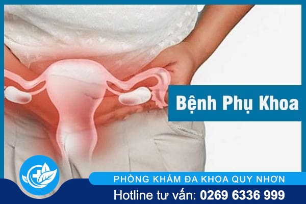 Tổng hợp cách chữa bệnh phụ khoa thường gặp