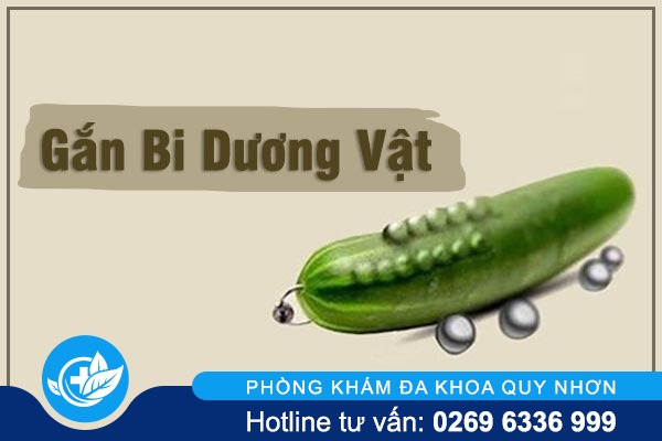 Tổng hợp những điều cần biết về gắn bi dương vật