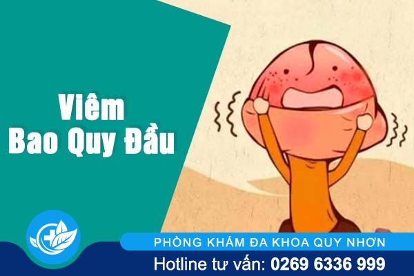 Viêm bao quy đầu không phải là một căn bệnh đơn giản