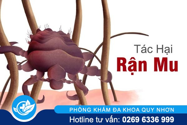 Điểm danh hàng loạt tác hại rận mu 
