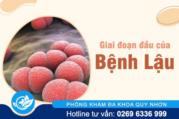 Giai đoạn đầu của bệnh lậu như thế nào?