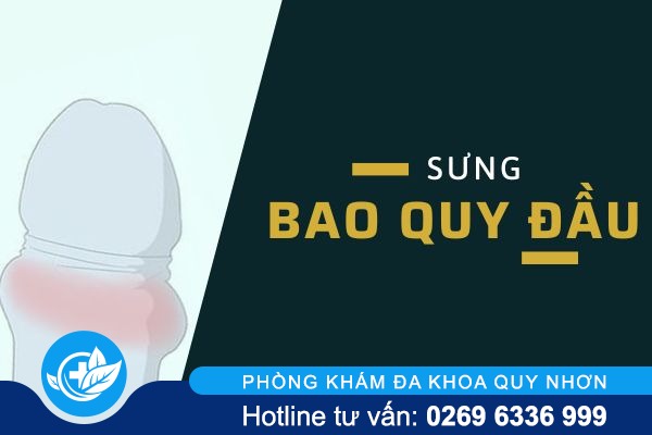 Nguyên nhân gây sưng bao quy đầu và phương pháp điều trị
