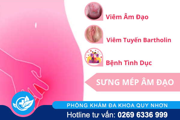 nguyen-nhan-gay-sung-mep-am-dao-va-cach-giai-quyet-02