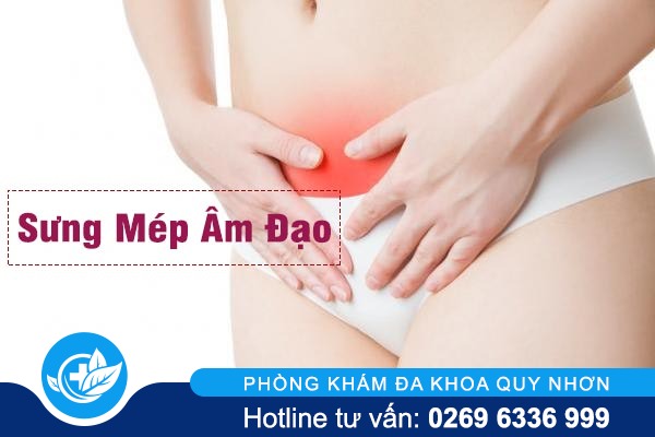 Nguyên nhân gây sưng mép âm đạo và cách giải quyết
