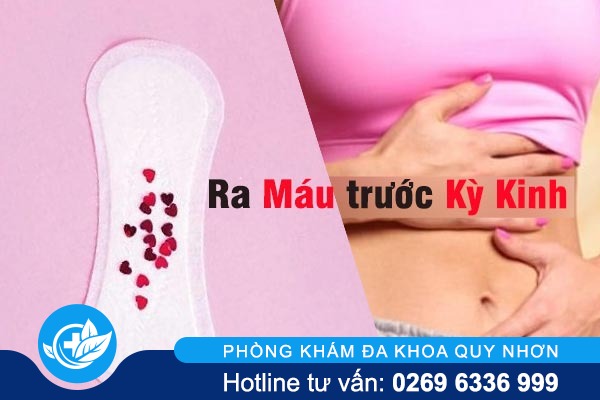 Tại sao lại bị ra máu trước kỳ kinh?