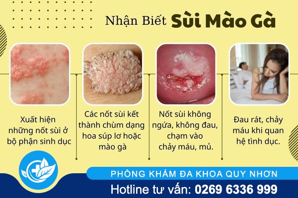 4-bien-phap-chua-sui-mao-ga-den-tu-huu-nghi-2