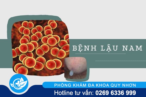 Bệnh lậu nam nguy hiểm như thế nào? 