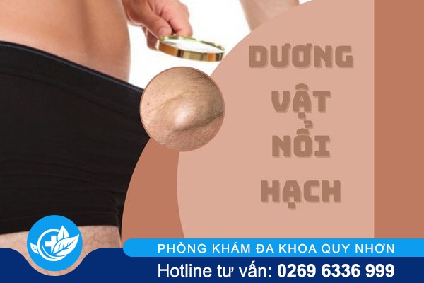 Đừng xem thường hiện tượng dương vật nổi hạch