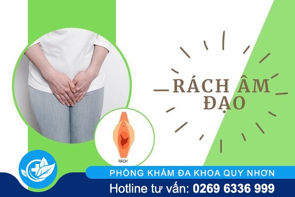 Nguyên nhân gây rách âm đạo và cách điều trị hiệu quả