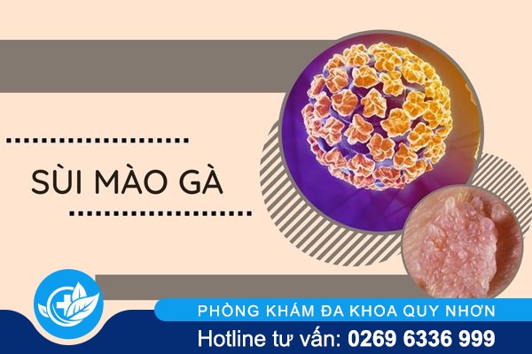 nhan-biet-dung-dau-hieu-benh-xa-hoi-de-kip-thoi-dieu-tri-2