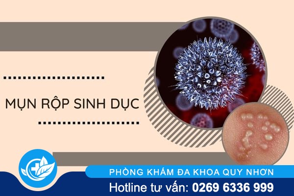 nhan-biet-dung-dau-hieu-benh-xa-hoi-de-kip-thoi-dieu-tri-3