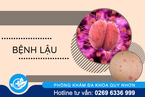 nhan-biet-dung-dau-hieu-benh-xa-hoi-de-kip-thoi-dieu-tri-4