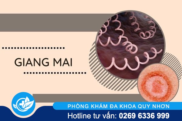 nhan-biet-dung-dau-hieu-benh-xa-hoi-de-kip-thoi-dieu-tri-5