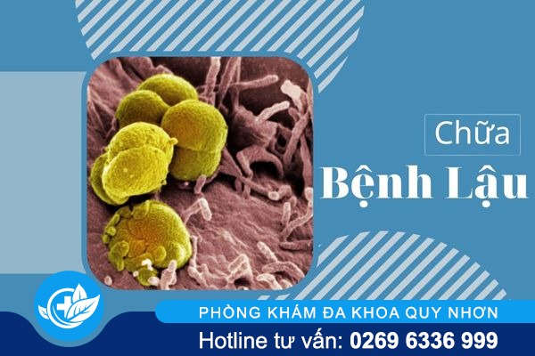 Tại sao công nghệ DHA chữa bệnh lậu hiệu quả?