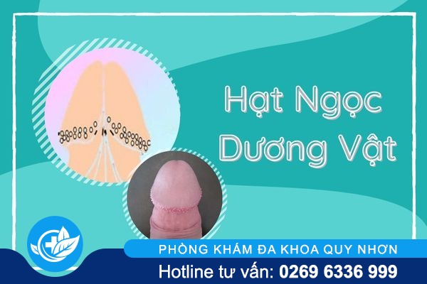 tim-hieu-ve-hat-ngoc-duong-vat-va-cach-dieu-tri-hieu-qua-2