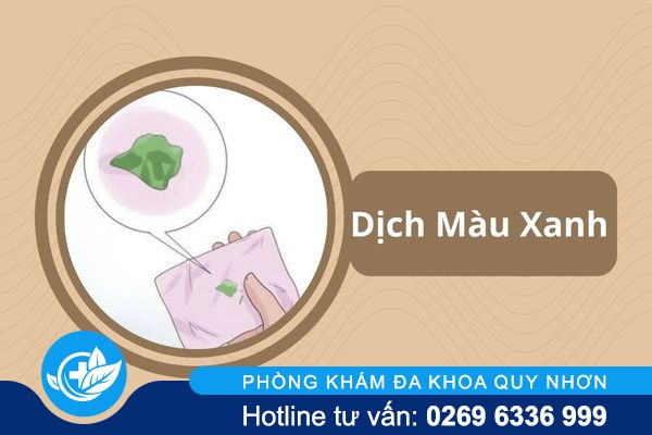 Dịch màu xanh – Dấu hiệu của bệnh phụ khoa nguy hiểm