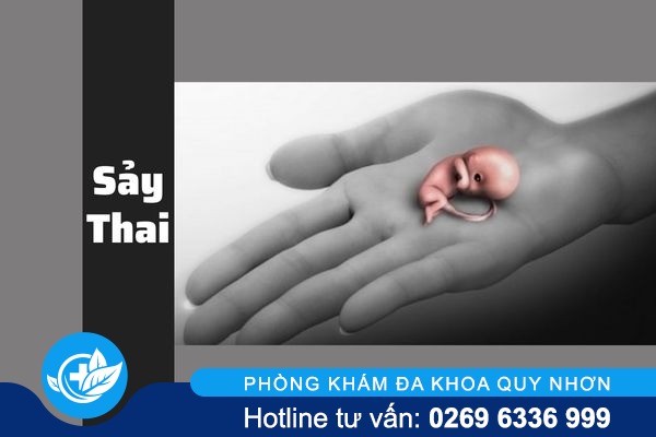 Hiểu đúng về sảy thai và cách khắc phục đúng đắn