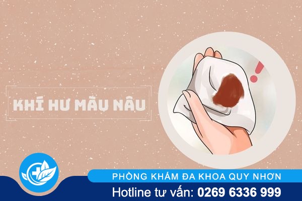Nguyên nhân gây ra khí hư màu nâu và cách điều trị hiệu quả