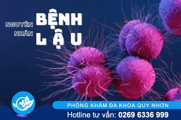 Bạn đã nắm rõ về nguyên nhân bệnh lậu chưa?