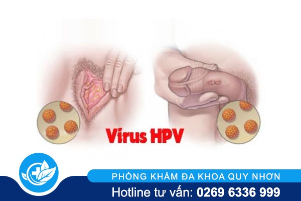 canh-bao-dung-xem-thuong-mun-mu-vung-kin-1