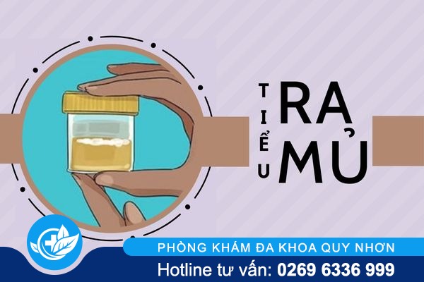 Cảnh báo sự nguy hiểm của tình trạng tiểu ra mủ