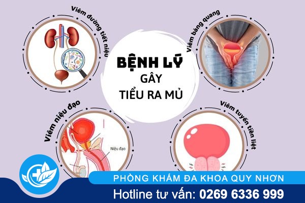 canh-bao-su-nguy-hiem-cua-tinh-trang-tieu-ra-mu-2