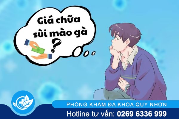 Giá chữa sùi mào gà hiện nay là bao nhiêu?