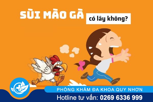 Sùi mào gà có lây không và qua đường nào?