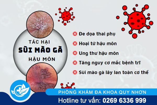 sui-mao-ga-hau-mon-nguy-hiem-khon-luong-nhung-it-ai-biet-2