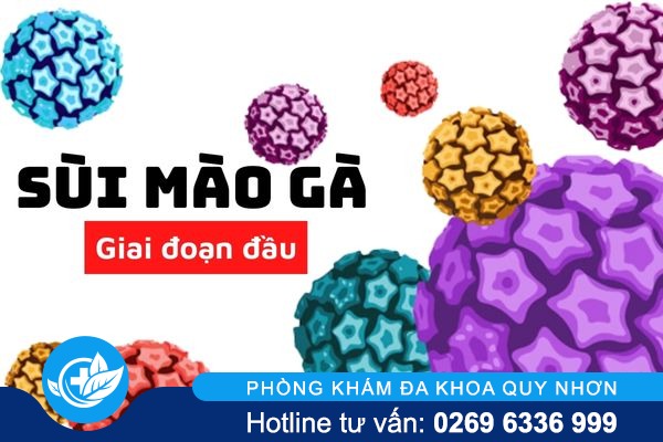 Thế nào là sùi mào gà giai đoạn đầu và điều trị ra sao? 