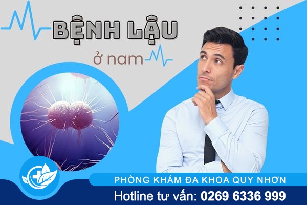 Thông tin về bệnh lậu ở nam và cách điều trị tối ưu nhất