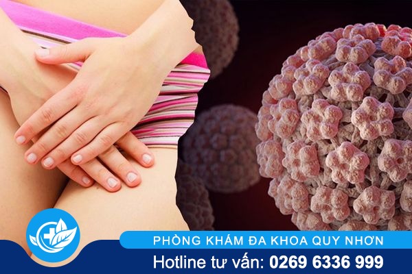 Thông tin về sùi mào gà ở môi lớn và môi bé