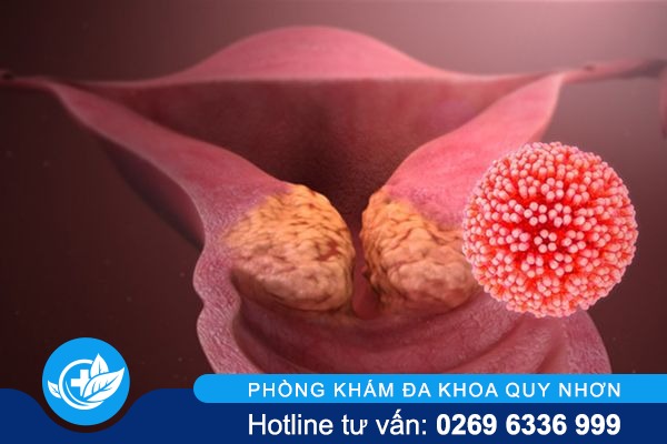 tong-hop-thong-tin-ve-sui-mao-ga-co-tu-cung-1