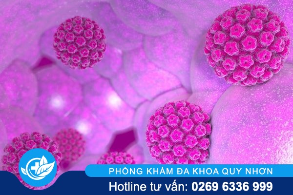 Tổng quan sùi mào gà ở nam và nữ