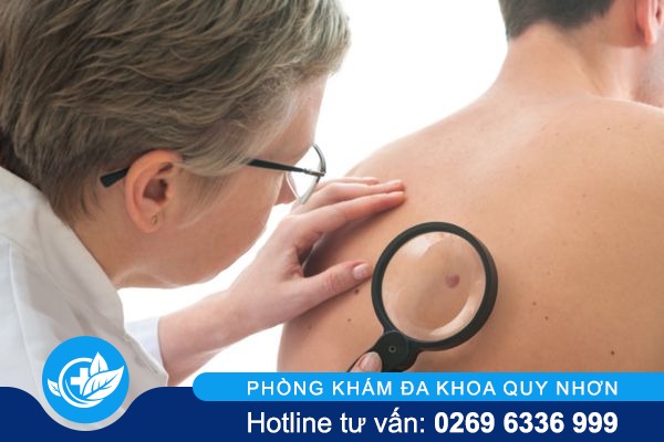 Dấu hiệu giang mai qua từng giai đoạn và biện pháp chữa trị