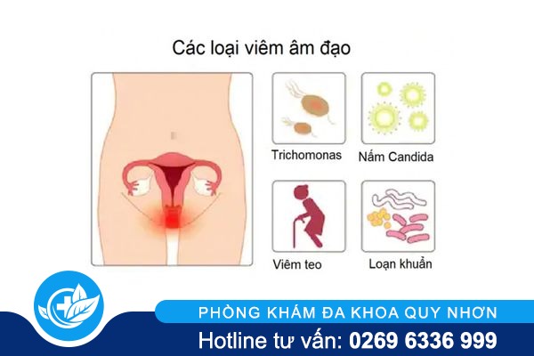 kho-rat-am-dao-xuat-phat-tu-dau-1