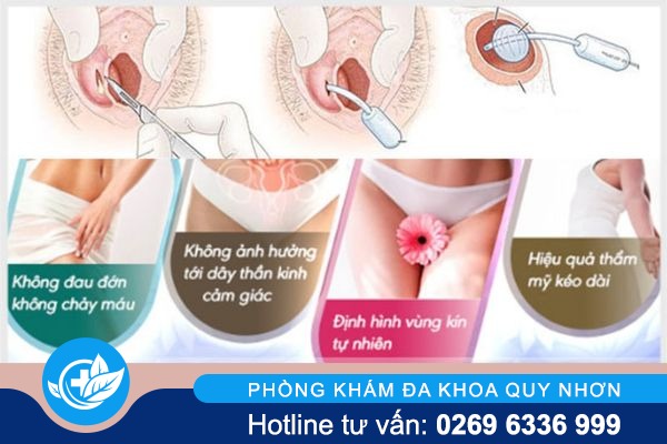 mang-trinh-day-la-gi (4)