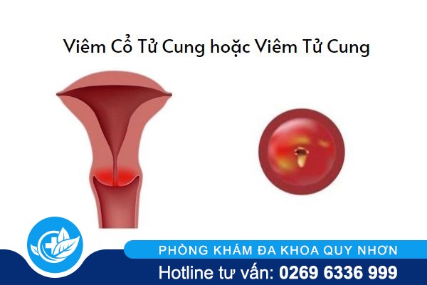 tai-sao-bi-dau-bung-duoi-sau-khi-quan-he-1