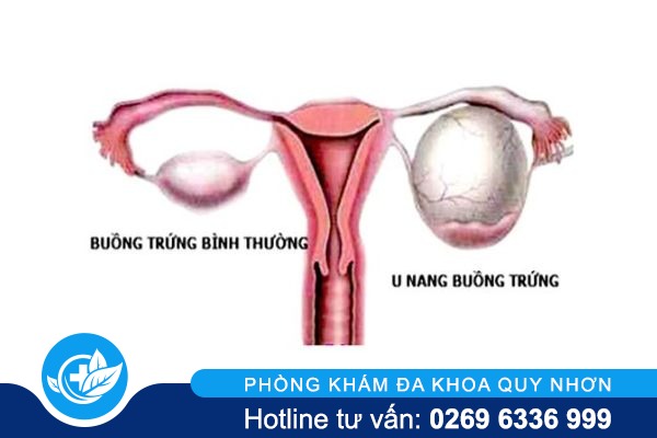 tai-sao-bi-dau-bung-duoi-sau-khi-quan-he-2