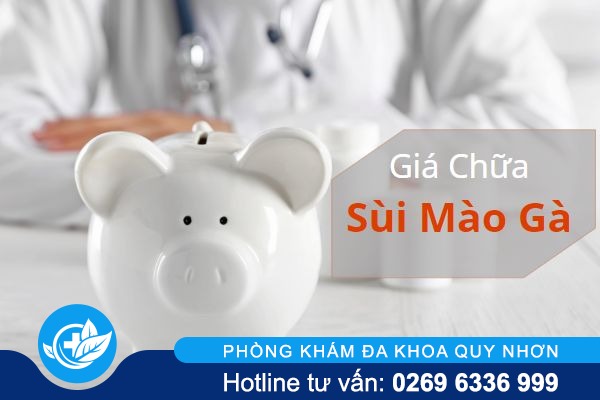 Xác định chi phí chữa sùi mào đúng nhất