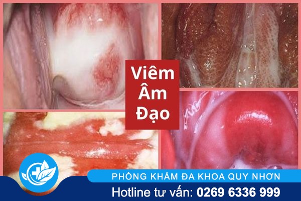 can-than-voi-tinh-trang-am-dao-bi-hoi-1