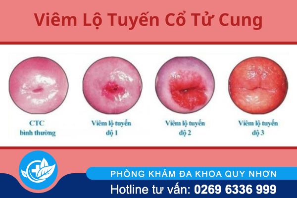 can-than-voi-tinh-trang-am-dao-bi-hoi-2