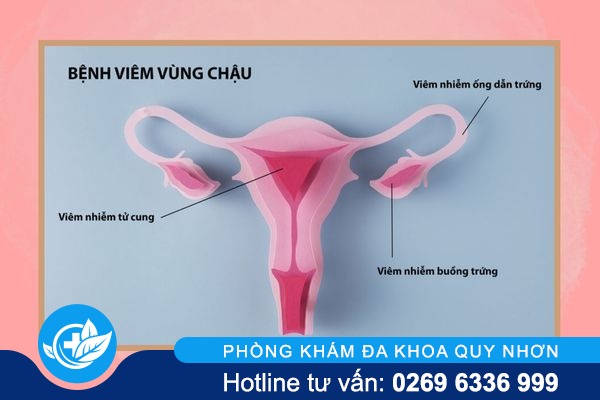 dau-rat-vung-kin-la-benh-gi-va-tri-the-nao-moi-het-2