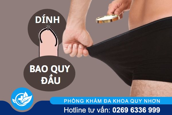 Dính bao quy đầu ngỡ lạ nhưng lạ khá quen